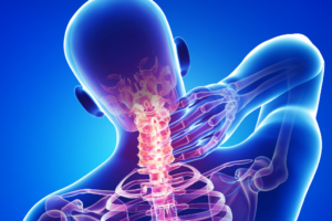 La douleur musculosquelettique